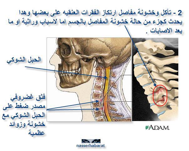 neck pain neck-pain2.jpg