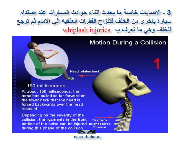 neck pain neck-pain3.jpg