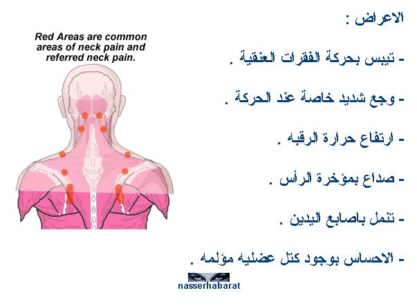 neck pain neck-pain5.jpg