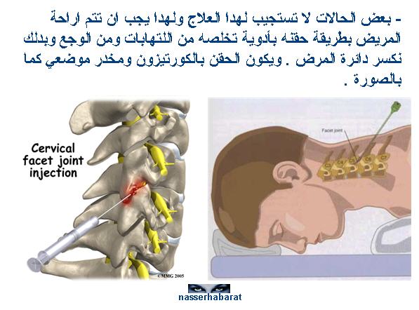 neck pain neck-pain8.jpg