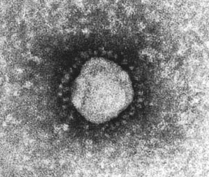 الكورونا الفيروسي 3cbb61cec4.jpg