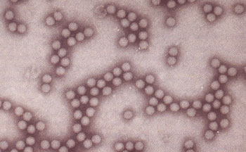 التهاب الكبد الفيروسي أ ( إلتهاب الكبد الوبائي ) Hepatitis A
